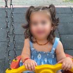 Mersin'de patlayan domates konservesi 9 aylık bebeği yaktı