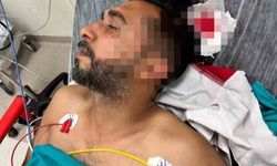 Adana’da döner ustası çalışırken başından yorgun mermiyle yaralandı