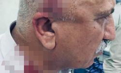 Kerkük'te kaçak yapı yıkımı sırasında kaymakama bıçaklı ve sopalı saldırı