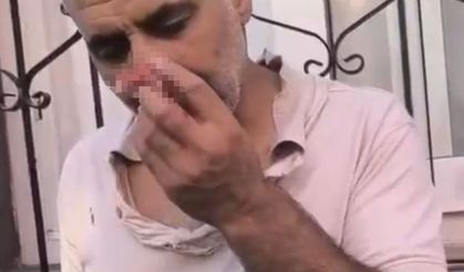 Cami müezzinini bıçaklayan şüpheli tutuklandı