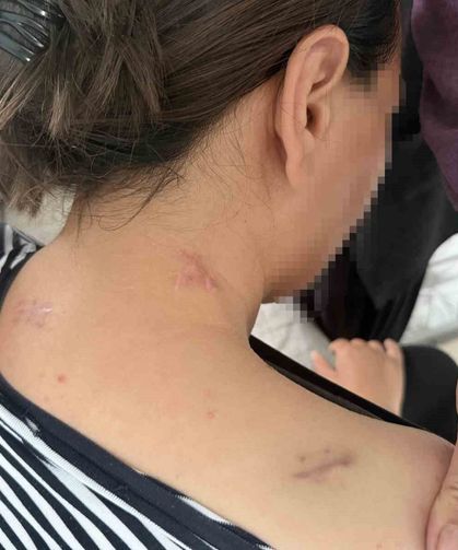 17 bıçak darbesi aldı, ölü numarasıyla kurtuldu, kocasının en ağır cezayı almasını istedi