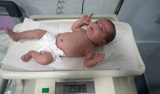 895 gram doğan Güneş bebek hayata tutundu