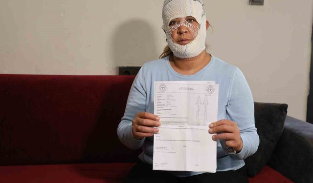 Güzelleşmek uğruna gittiği merkezde yüzü yandı