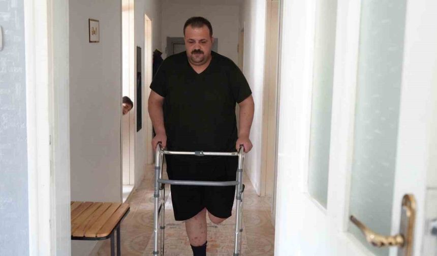 Terapi sonrası felaket: Tedavi için gitti, ayağı kesildi